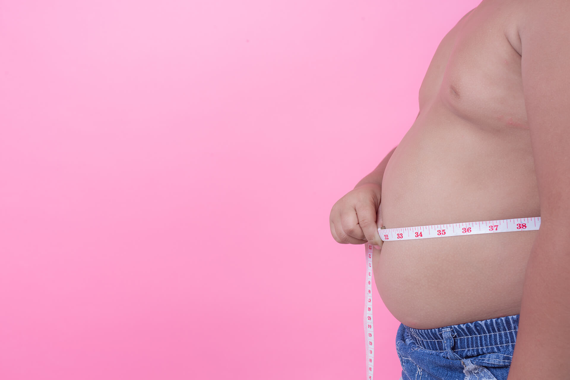 Obesity - Much more than a cosmetic problem